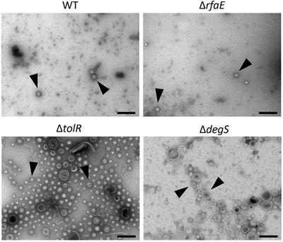 “One for All”: Functional Transfer of OMV-Mediated Polymyxin B Resistance From Salmonella enterica sv. Typhi ΔtolR and ΔdegS to Susceptible Bacteria